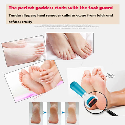Electric Foot Skin Remover – Rechargeable Callus Remover for Feet – Smooth & Soft Skin Instantly